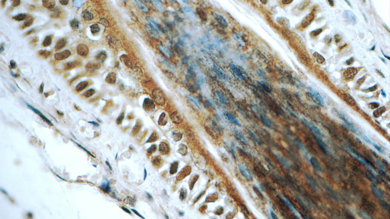 Immunohistochemistry of paraffin-embedded human skin tissue slide using Catalog No:113911(PINX1 Antibody) at dilution of 1:50 (under 40x lens)