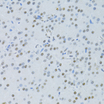 Immunohistochemistry - SNRNP70 Polyclonal Antibody 