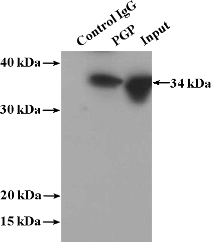IP Result of anti-PGP (IP:Catalog No:113792, 4ug; Detection:Catalog No:113792 1:600) with Y79 cells lysate 1920ug.