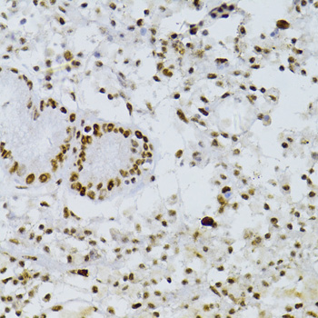 Immunohistochemistry - SNRNP70 Polyclonal Antibody 