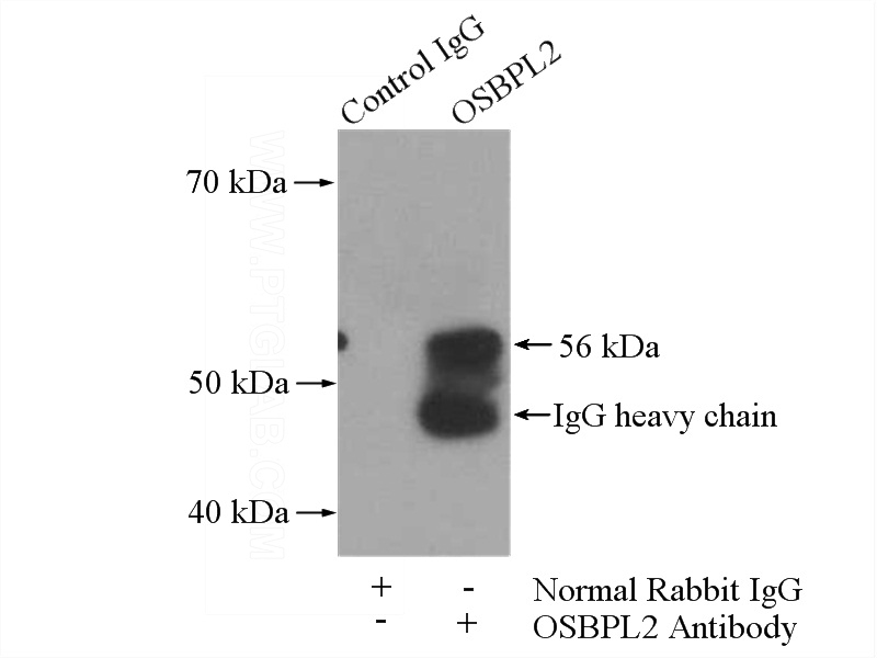 IP Result of anti-OSBPL2 (IP:Catalog No:113432, 4ug; Detection:Catalog No:113432 1:500) with HeLa cells lysate 880ug.