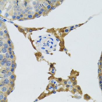 Immunohistochemistry - PLA2G2D Polyclonal Antibody 