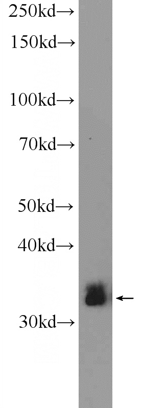 HeLa cells were subjected to SDS PAGE followed by western blot with Catalog No:108235(ARAF Antibody) at dilution of 1:600