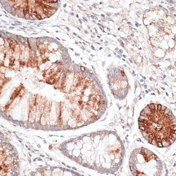 Immunohistochemistry - KIR3DL3 Polyclonal Antibody 