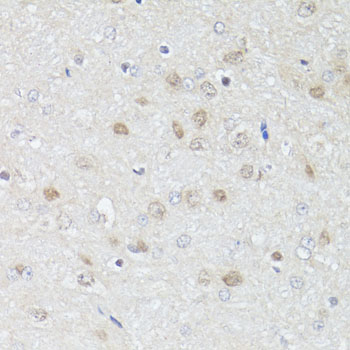 Immunohistochemistry - GRM4 Polyclonal Antibody 