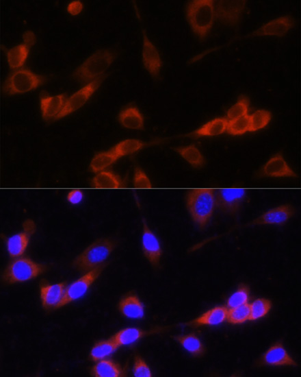 Immunofluorescence - GANAB Polyclonal Antibody 