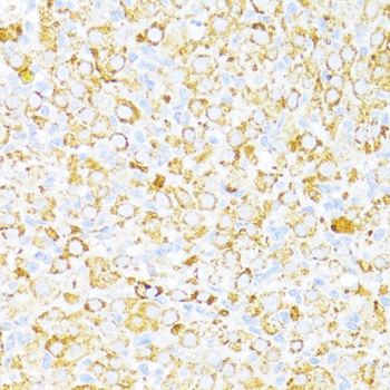 Immunohistochemistry - ALDH6A1 Polyclonal Antibody 