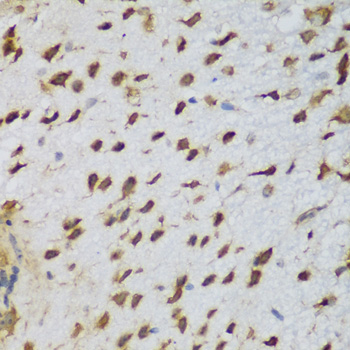Immunohistochemistry - NCL Polyclonal Antibody 