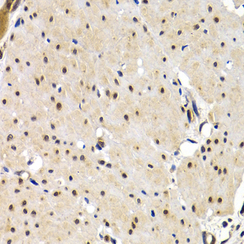 Immunohistochemistry - IRF2 Polyclonal Antibody 