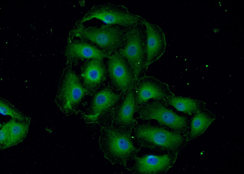 Immunofluorescent analysis of SH-SY5Y cells using Catalog No:112977(MYO10 Antibody) at dilution of 1:50 and Alexa Fluor 488-congugated AffiniPure Goat Anti-Rabbit IgG(H+L)