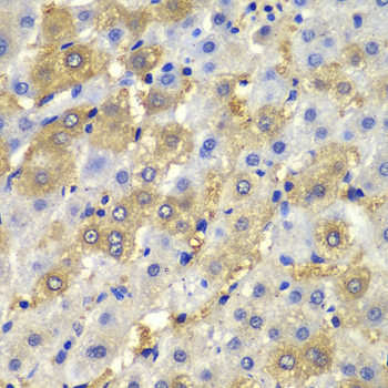 Immunohistochemistry - DSP Polyclonal Antibody 
