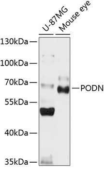 Western blot - PODN Polyclonal Antibody 