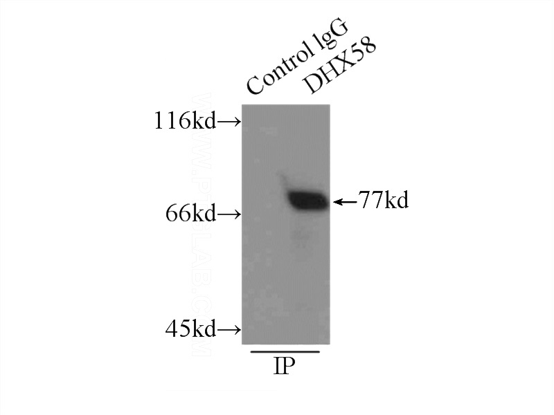 IP Result of anti-DHX58 (IP:Catalog No:112209, 3ug; Detection:Catalog No:112209 1:300) with mouse liver tissue lysate 6000ug.