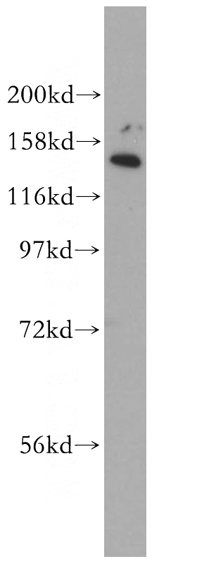 HepG2 cells were subjected to SDS PAGE followed by western blot with Catalog No:110222(EHBP1 antibody) at dilution of 1:500