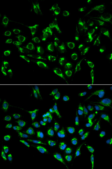 Immunofluorescence - CDKN3 Polyclonal Antibody 