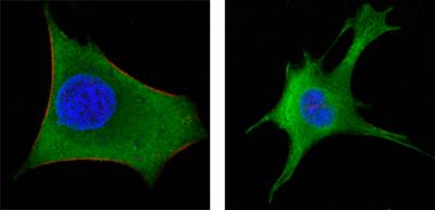 Confocal immunofluorescence analysis of Hela (left) and 3T3-L1 (right) cells using WNT1 mouse mAb (green). Red: Actin filaments have been labeled with DY-554 phalloidin. Blue: DRAQ5 fluorescent DNA dye.