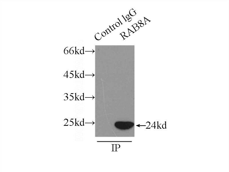 IP Result of anti-RAB8A (IP:Catalog No:114460, 3ug; Detection:Catalog No:114460 1:500) with HeLa cells lysate 2500ug.