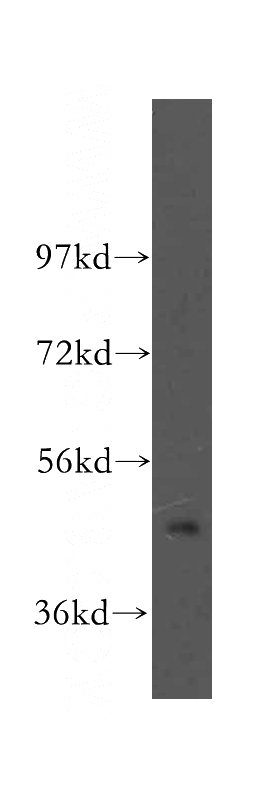 Jurkat cells were subjected to SDS PAGE followed by western blot with Catalog No:115203(SERPINB2 antibody) at dilution of 1:400