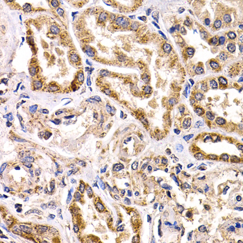 Immunohistochemistry - FZR1 Polyclonal Antibody 