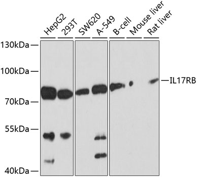 Western blot - IL17RB Polyclonal Antibody 