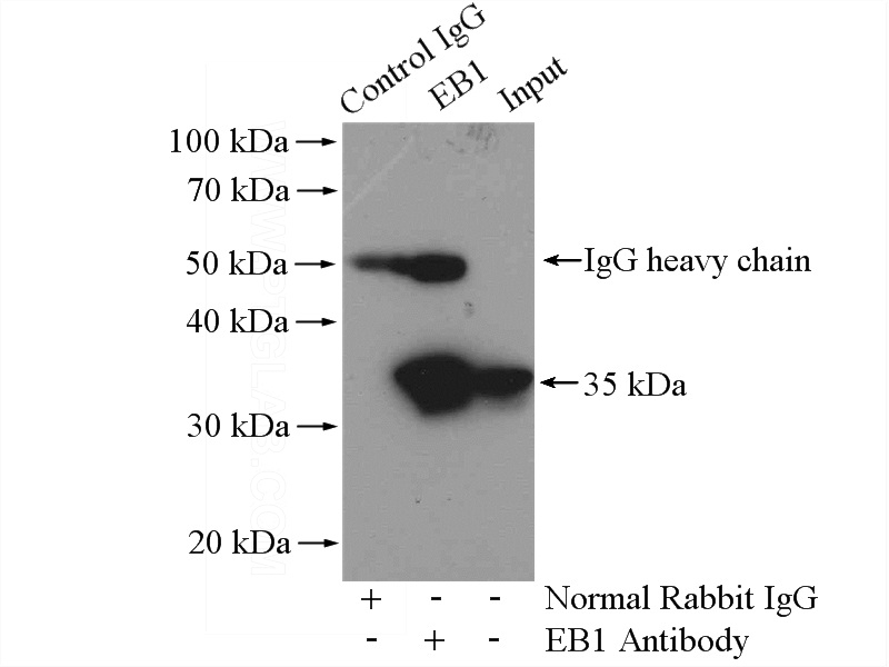 IP Result of anti-EB1 (IP:Catalog No:110165, 4ug; Detection:Catalog No:110165 1:1000) with HeLa cells lysate 1200ug.