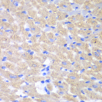 Immunohistochemistry - GPAM Polyclonal Antibody 