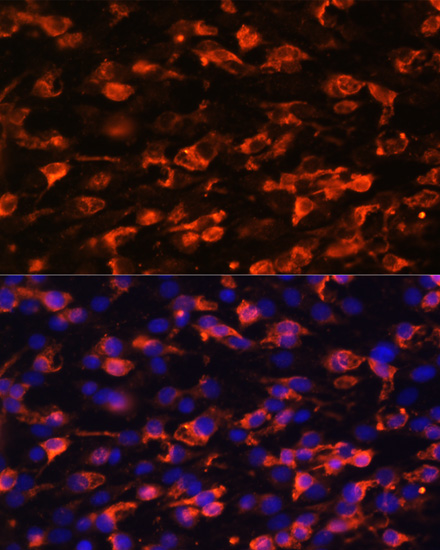 Immunofluorescence - PIK3C2A Polyclonal Antibody 