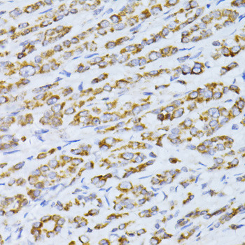 Immunohistochemistry - CCDC92 Polyclonal Antibody 