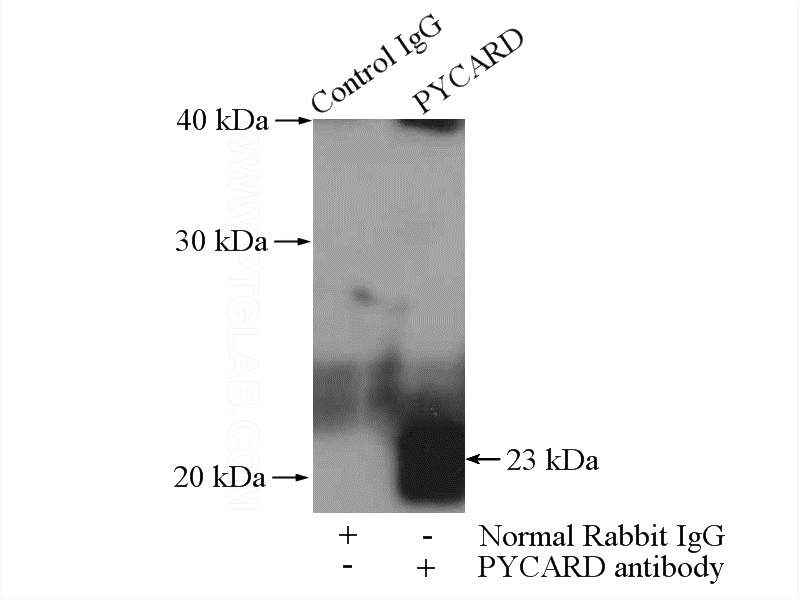 IP Result of anti-TMS1 (IP:Catalog No:116279, 4ug; Detection:Catalog No:116279 1:2000) with HL-60 cells lysate 4000ug.