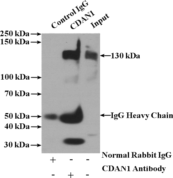 IP Result of anti-CDAN1 (IP:Catalog No:109090, 4ug; Detection:Catalog No:109090 1:500) with K-562 cells lysate 3200ug.