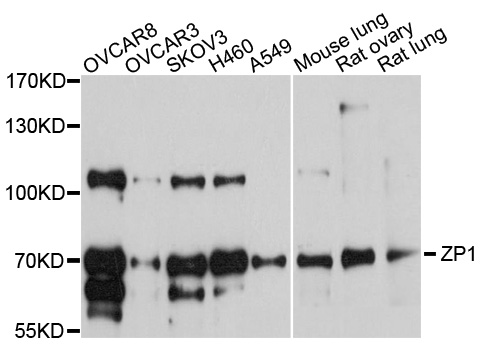 Western blot - ZP1 Polyclonal Antibody 