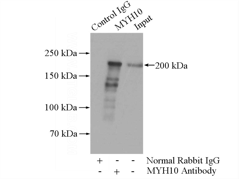 IP Result of anti-MYH10 (IP:Catalog No:112929, 4ug; Detection:Catalog No:112929 1:1500) with mouse brain tissue lysate 3440ug.