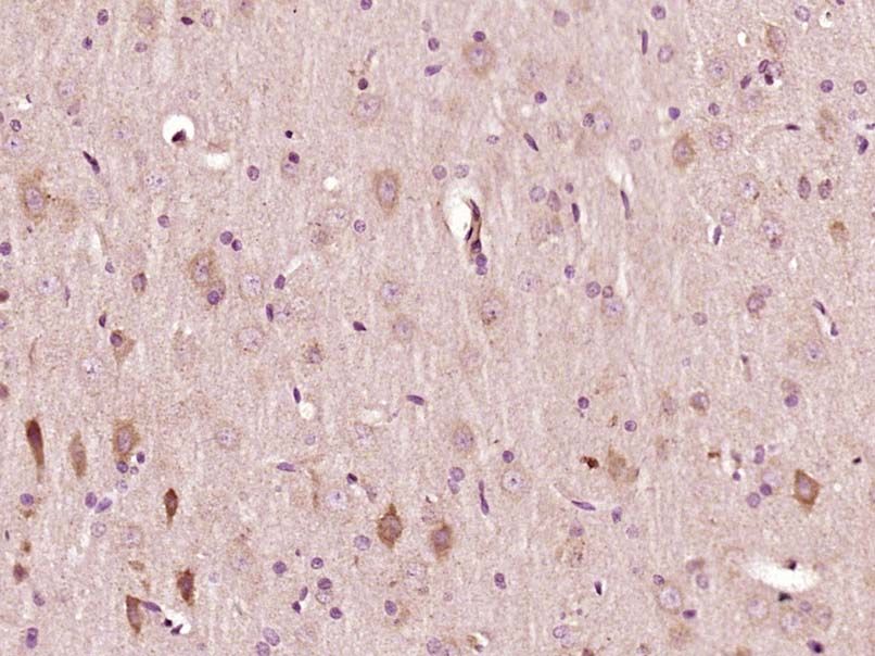Fig2: Paraformaldehyde-fixed, paraffin embedded (Rat brain); Antigen retrieval by boiling in sodium citrate buffer (pH6.0) for 15min; Block endogenous peroxidase by 3% hydrogen peroxide for 20 minutes; Blocking buffer (normal goat serum) at 37℃ for 30min; Antibody incubation with (CCDC63) Polyclonal Antibody, Unconjugated at 1:500 overnight at 4℃, followed by a conjugated secondary (sp-0023) for 20 minutes and DAB staining.