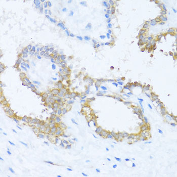 Immunohistochemistry - NAT2 Polyclonal Antibody 