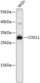 Western blot - COX11 Polyclonal Antibody 