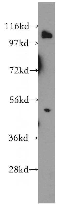 Jurkat cells were subjected to SDS PAGE followed by western blot with Catalog No:113169(NFKB1 antibody) at dilution of 1:1000