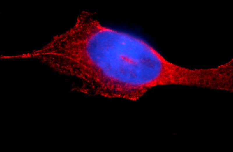 Immunofluorescent analysis of A431 cells using Catalog No:117072(AUP1 Antibody) at dilution of 1:25 and Rhodamine-Goat anti-Rabbit IgG