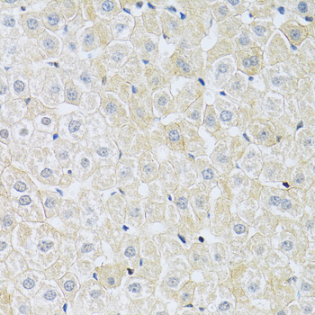 Immunohistochemistry - SLC4A5 Polyclonal Antibody 