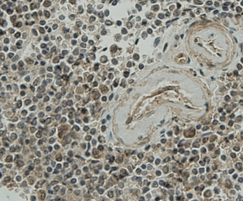 Fig7: Immunohistochemical analysis of paraffin-embedded human spleen tissue using anti-CCDC51 antibody. Counter stained with hematoxylin.