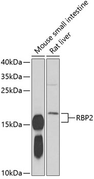 Western blot - RBP2 Polyclonal Antibody 