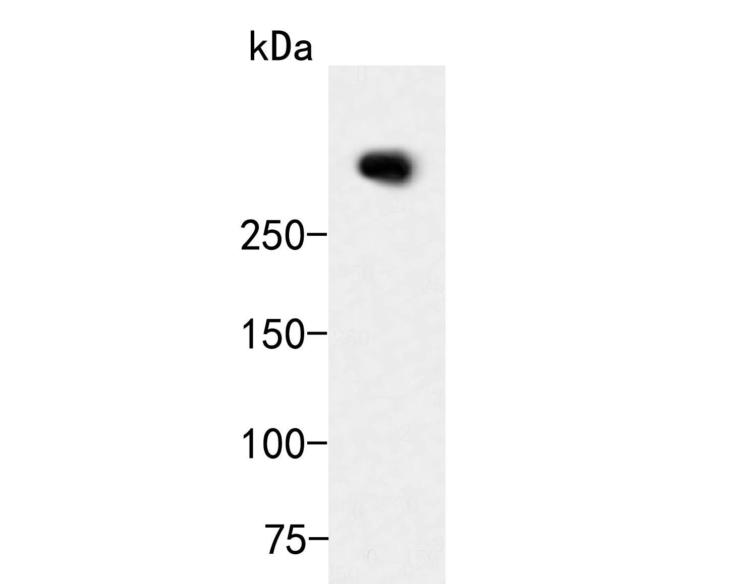 Fig1:; Western blot analysis of ATBF1 on MCF-7 cell lysates. Proteins were transferred to a PVDF membrane and blocked with 5% BSA in PBS for 1 hour at room temperature. The primary antibody ( 1/500) was used in 5% BSA at room temperature for 2 hours. Goat Anti-Rabbit IgG - HRP Secondary Antibody (HA1001) at 1:5,000 dilution was used for 1 hour at room temperature.