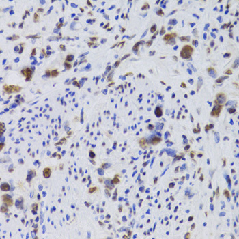 Immunohistochemistry - HDGF Polyclonal Antibody 