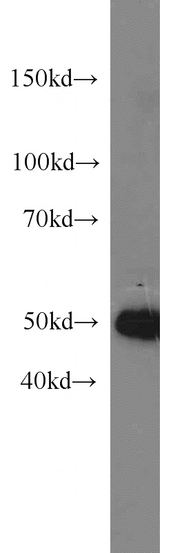 SKOV-3 cells were subjected to SDS PAGE followed by western blot with Catalog No:113572(pan-PAX antibody) at dilution of 1:300