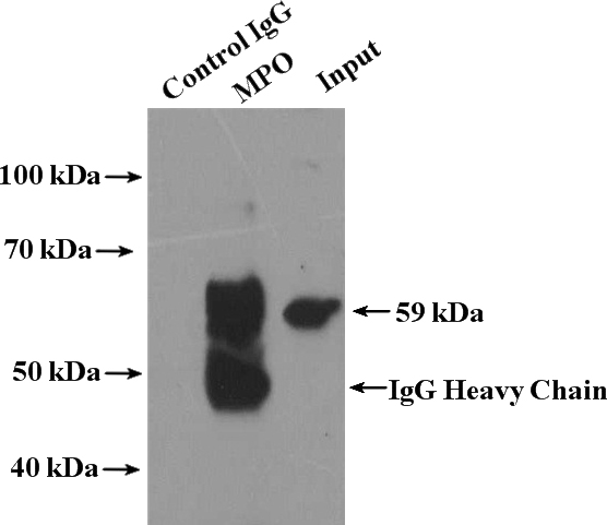 IP Result of anti-MPO (IP:Catalog No:112746, 4ug; Detection:Catalog No:112746 1:600) with HeLa cells lysate 1600ug.