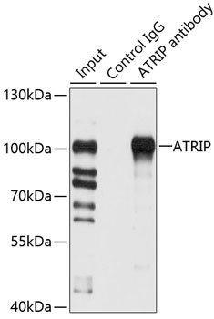 Immunoprecipitation - ATRIP Polyclonal Antibody 