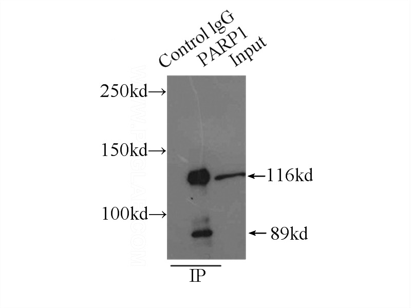 IP Result of anti-PARP1 (IP:Catalog No:113588, 4ug; Detection:Catalog No:113588 1:600) with K-562 cells lysate 5000ug.