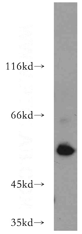 mouse lung tissue were subjected to SDS PAGE followed by western blot with Catalog No:107672(AAMP antibody) at dilution of 1:500