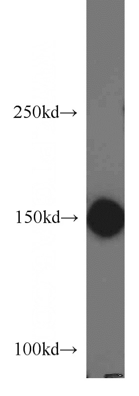 HepG2 cells were subjected to SDS PAGE followed by western blot with Catalog No:114777(RocK1 antibody) at dilution of 1:1000
