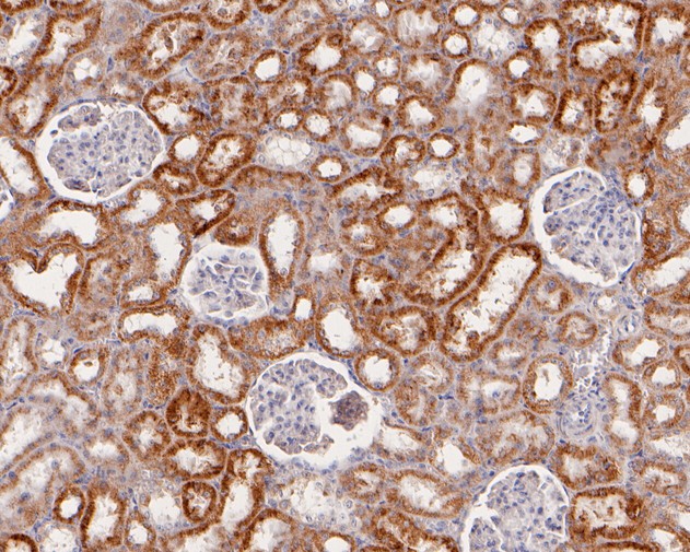 Fig2:; Immunohistochemical analysis of paraffin-embedded rat kidney tissue using anti-ACAA2 antibody. The section was pre-treated using heat mediated antigen retrieval with Tris-EDTA buffer (pH 8.0-8.4) for 20 minutes.The tissues were blocked in 5% BSA for 30 minutes at room temperature, washed with ddH; 2; O and PBS, and then probed with the primary antibody ( 1/50) for 30 minutes at room temperature. The detection was performed using an HRP conjugated compact polymer system. DAB was used as the chromogen. Tissues were counterstained with hematoxylin and mounted with DPX.