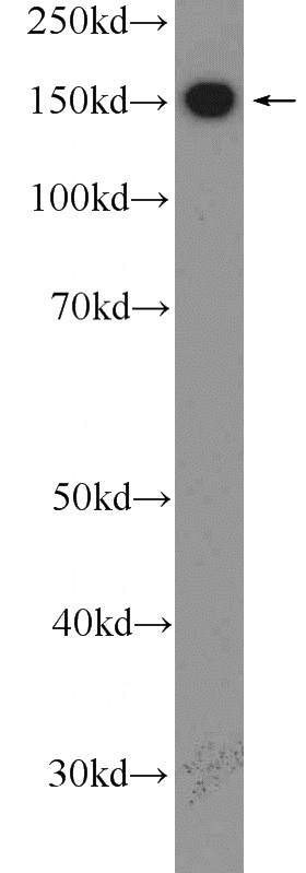 mouse heart tissue were subjected to SDS PAGE followed by western blot with Catalog No:112197(LEPR Antibody) at dilution of 1:1000